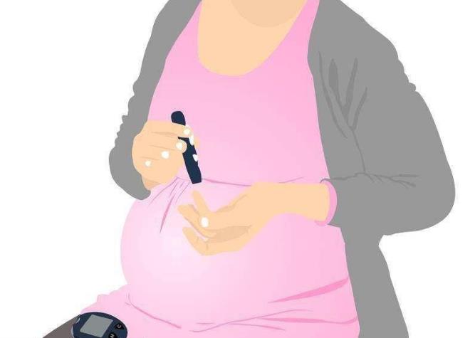 妊娠前糖尿病