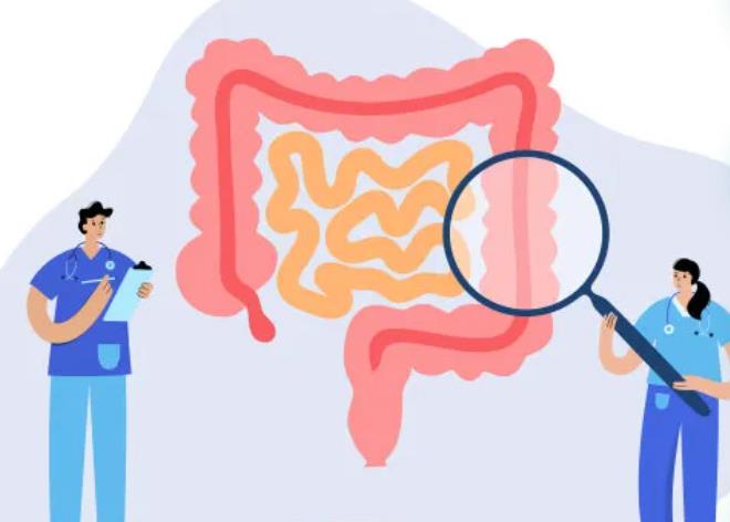 肠易激综合征