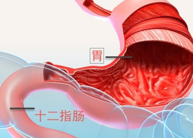 消化性溃疡的症状表现，一般都是什么地方痛？