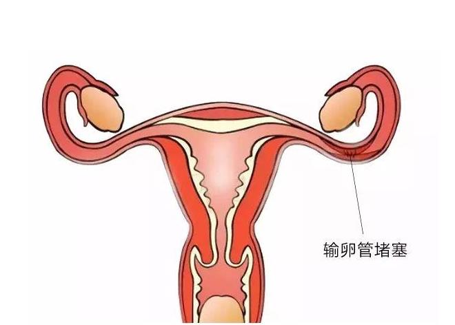 输卵管人体示意图图片
