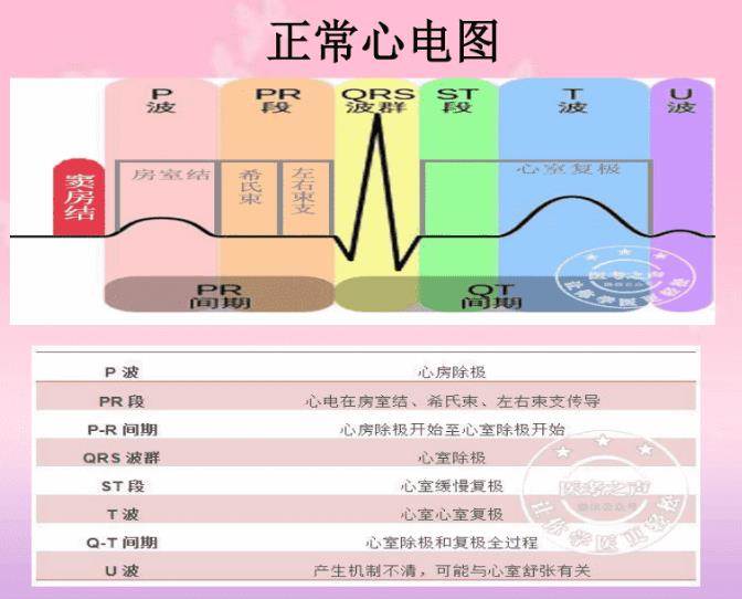 室性心动过速