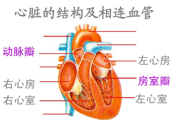 右心房扩大