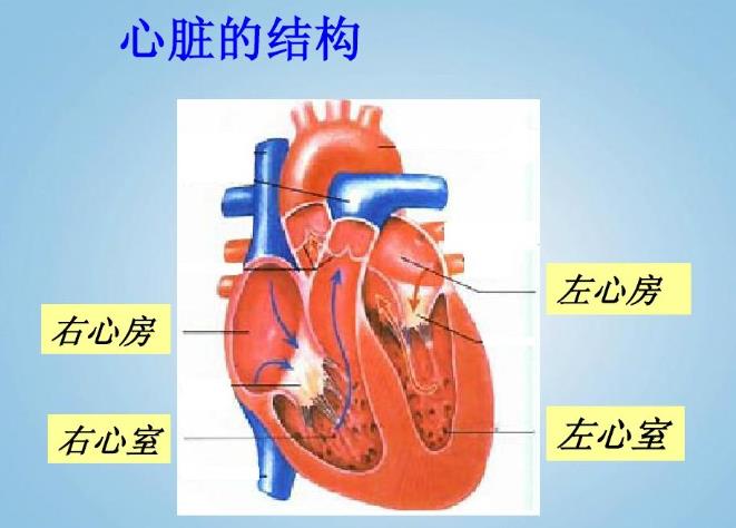 右心房扩大