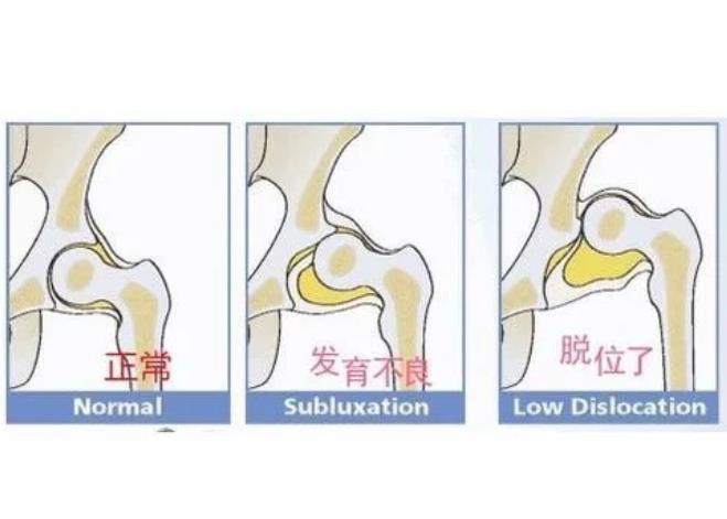 骨骼发育不良