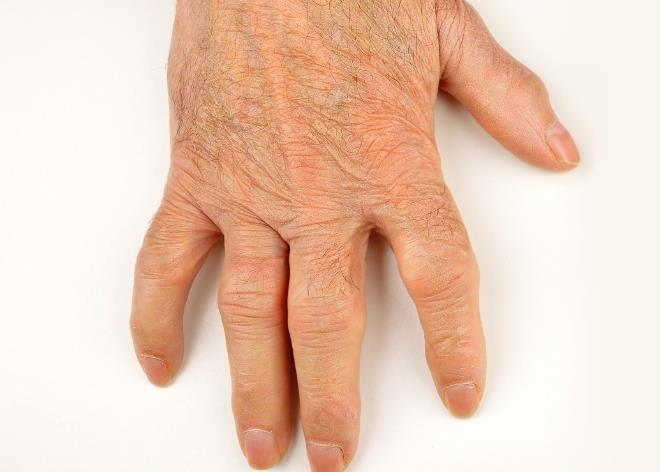 手指疼是什么原因图片
