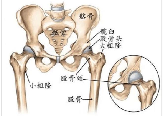 股骨头坏死