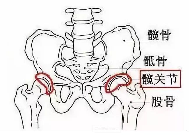 髋关节滑膜炎