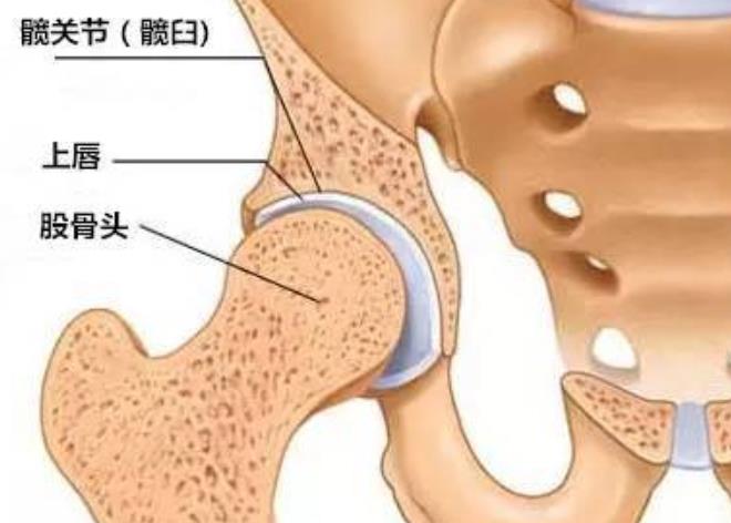 髋关节滑膜炎