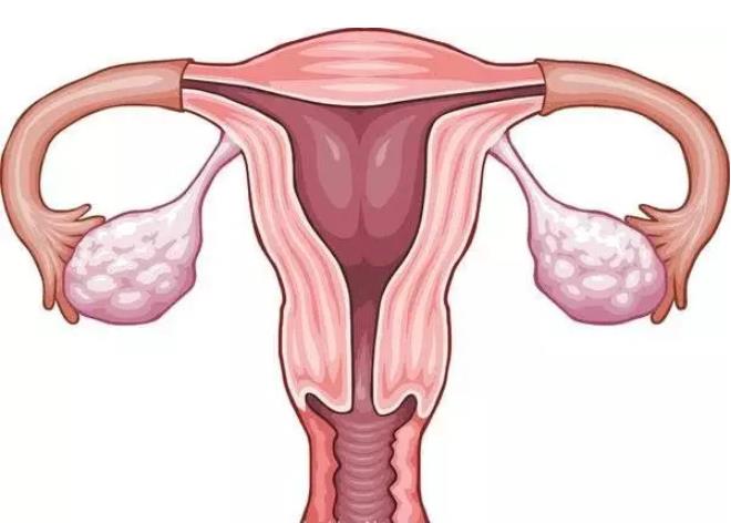 卵巢恶性中胚叶混合瘤
