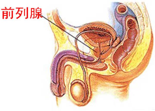 前列腺囊肿