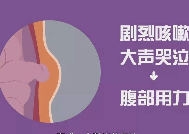 腹股沟疝气症状图片