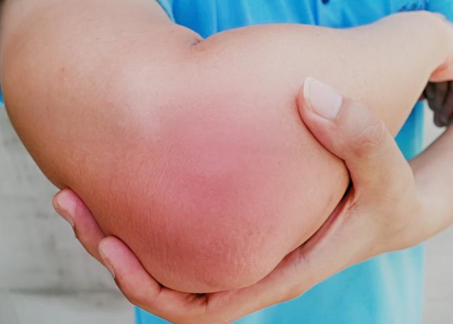手肘反复疼痛影响关节活动活动受限,再次疼痛是肘关节不适造成的,如果