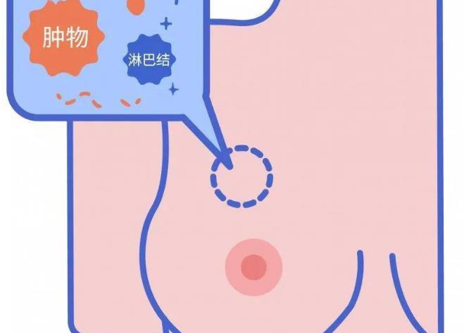 乳房