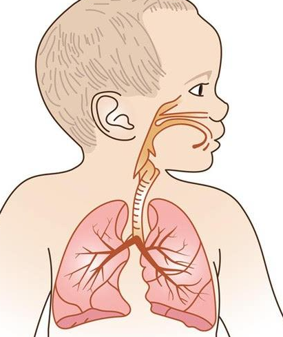 什么是小儿肺炎有什么表现怎么治疗