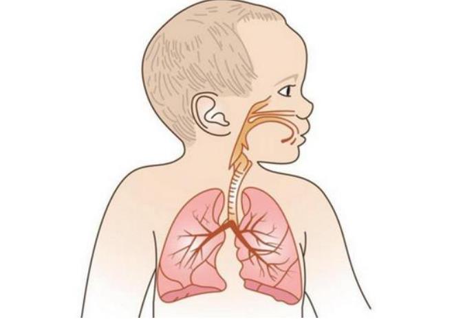 儿童死亡率很高的支气管肺炎，知道它的发病机制吗？要注意了