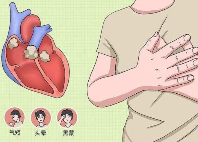 心肌炎可以治愈吗？确诊心肌炎后，该如何治疗？